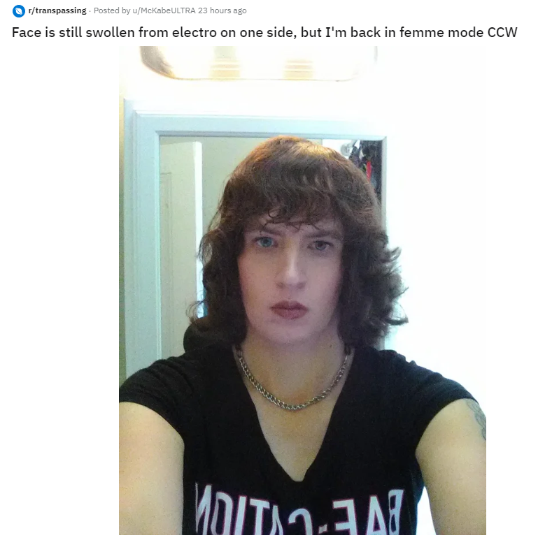 775862