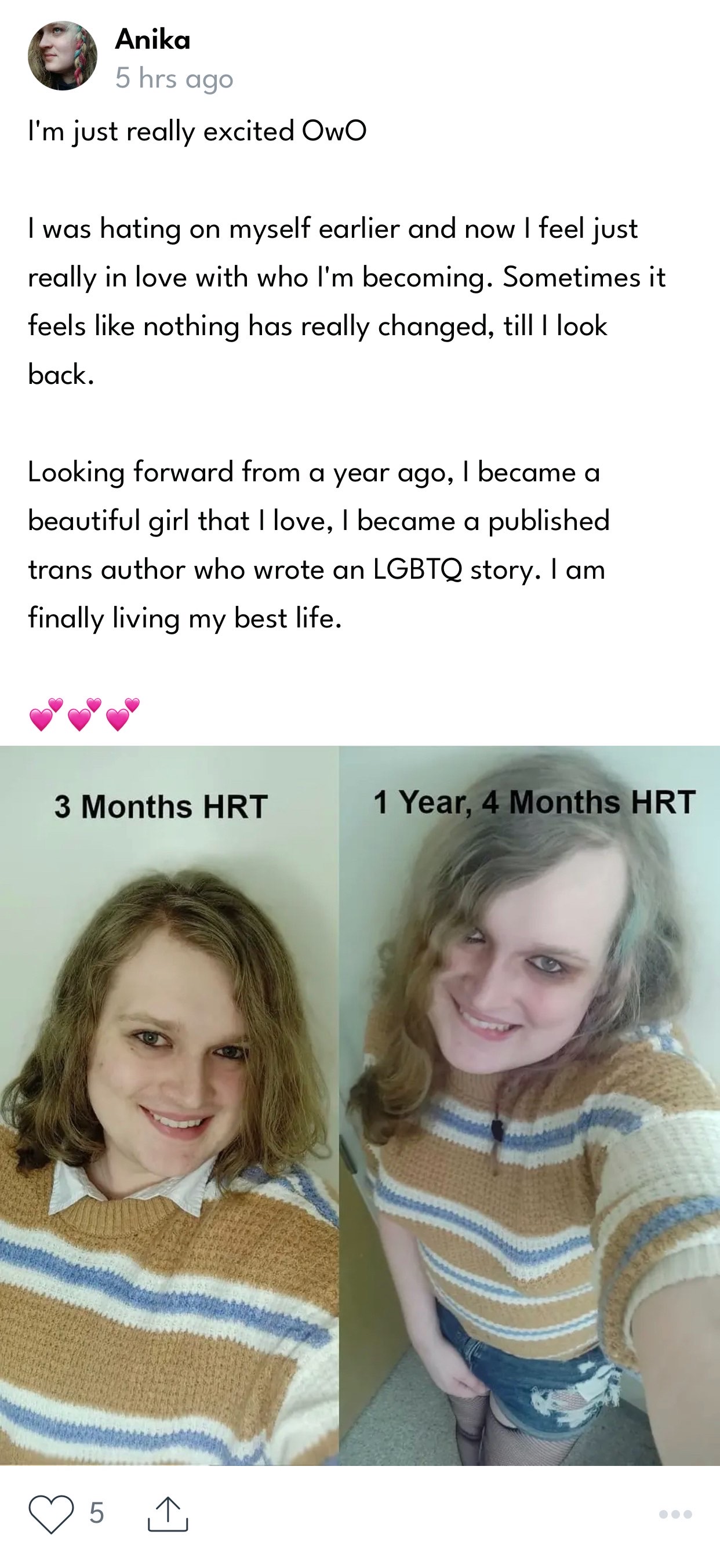 Anika before after.jpg