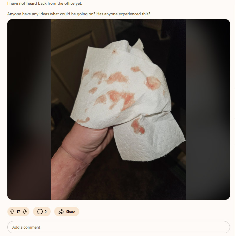 Bleeding_from_burial2.jpg