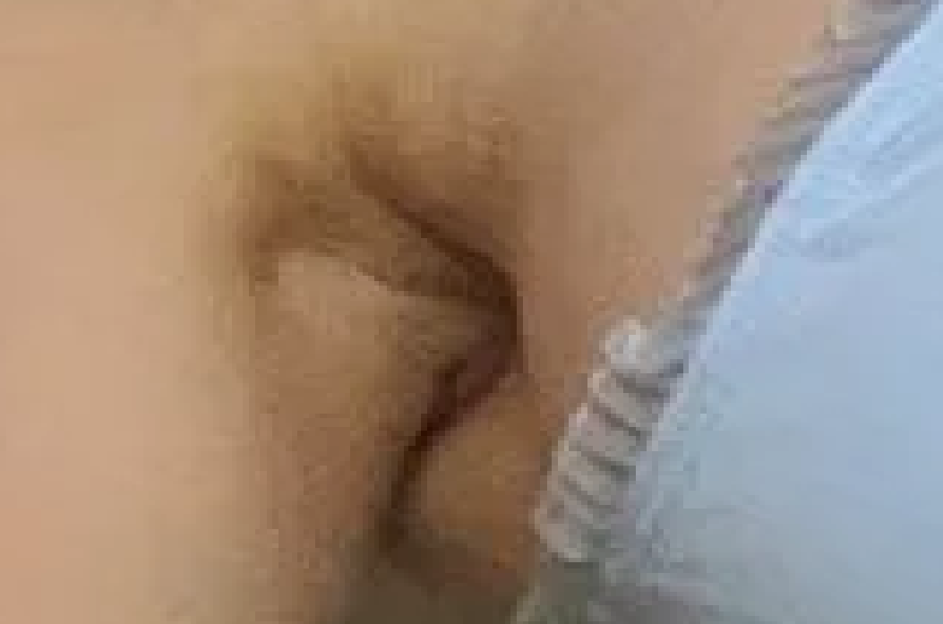 butthole.png