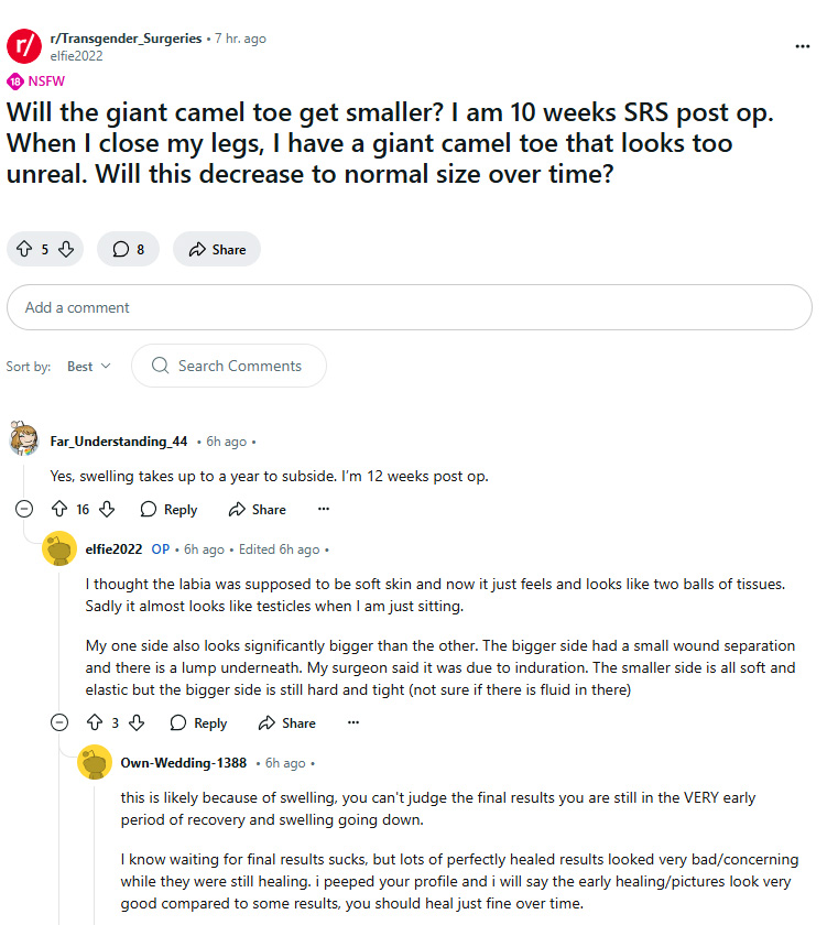 Camel_toe_troon.jpg