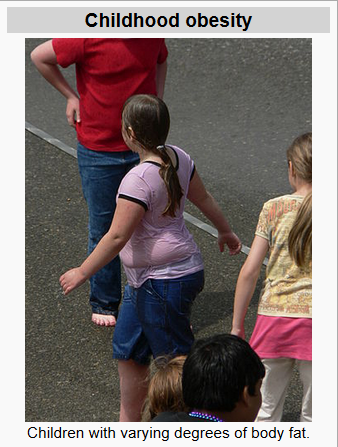 childhood obesity.PNG