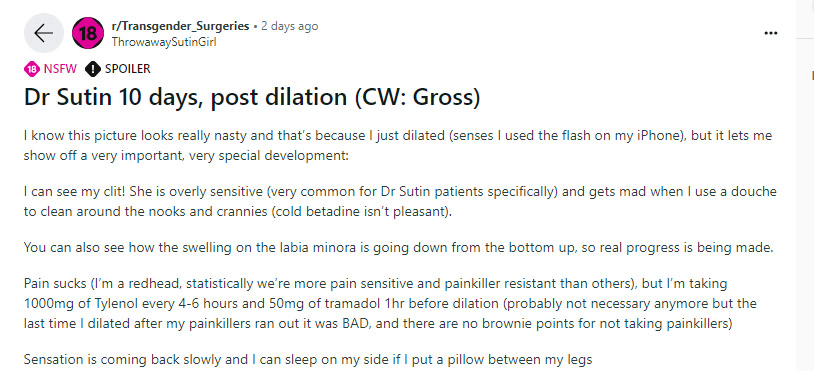 CW_gross1.jpg