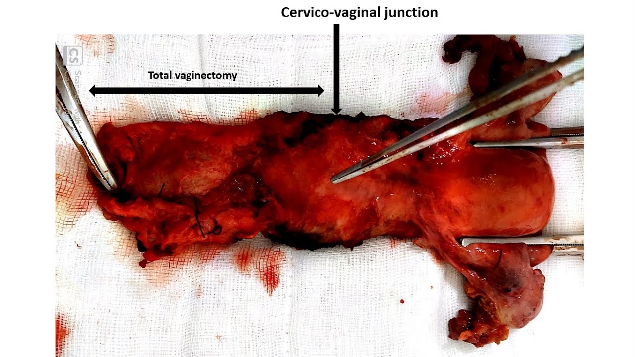 download.jpeg