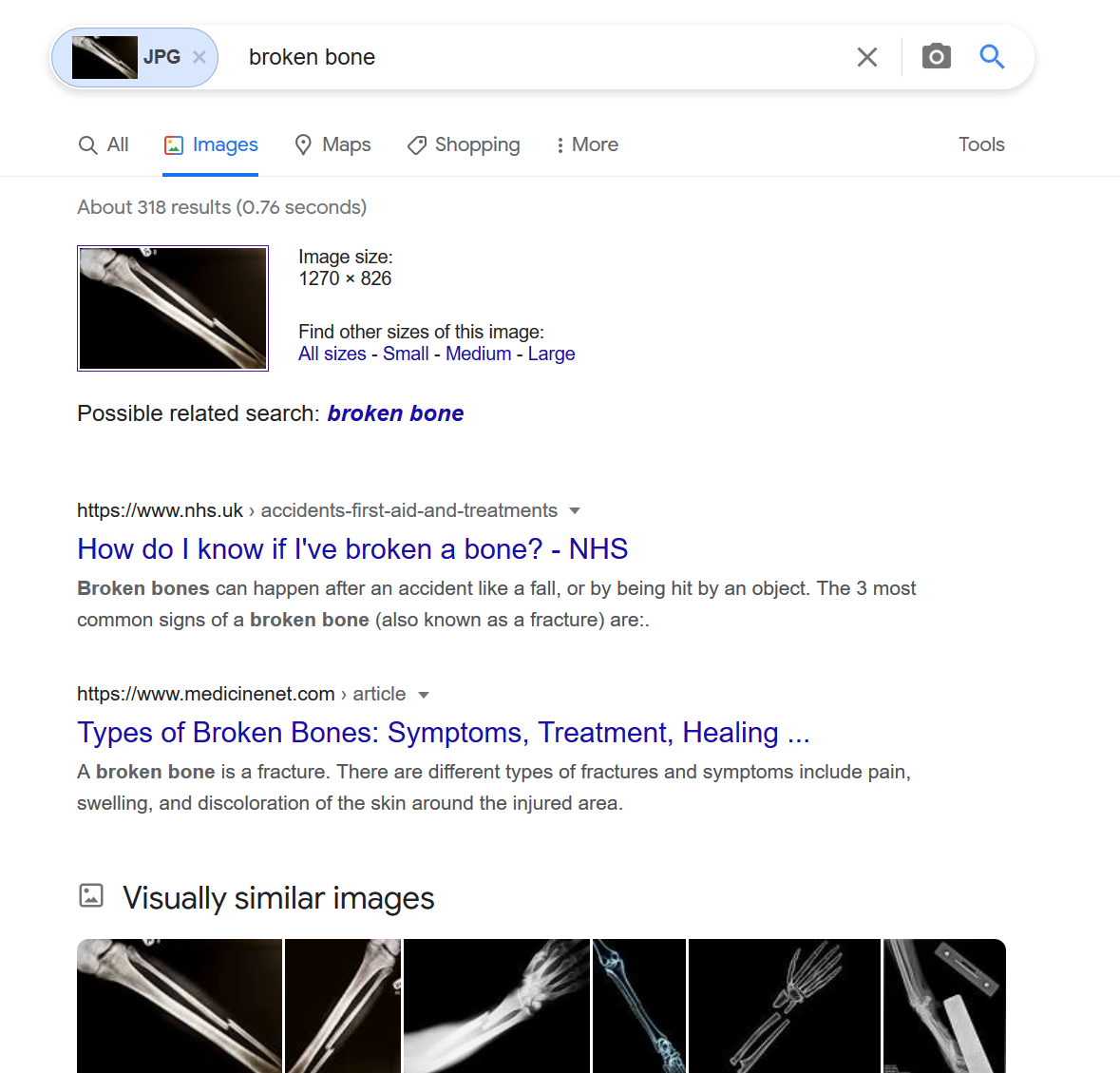 Fakebone.png