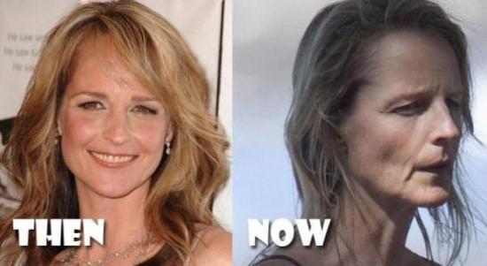 Helen-Hunt-Plastic-Surgery.jpg