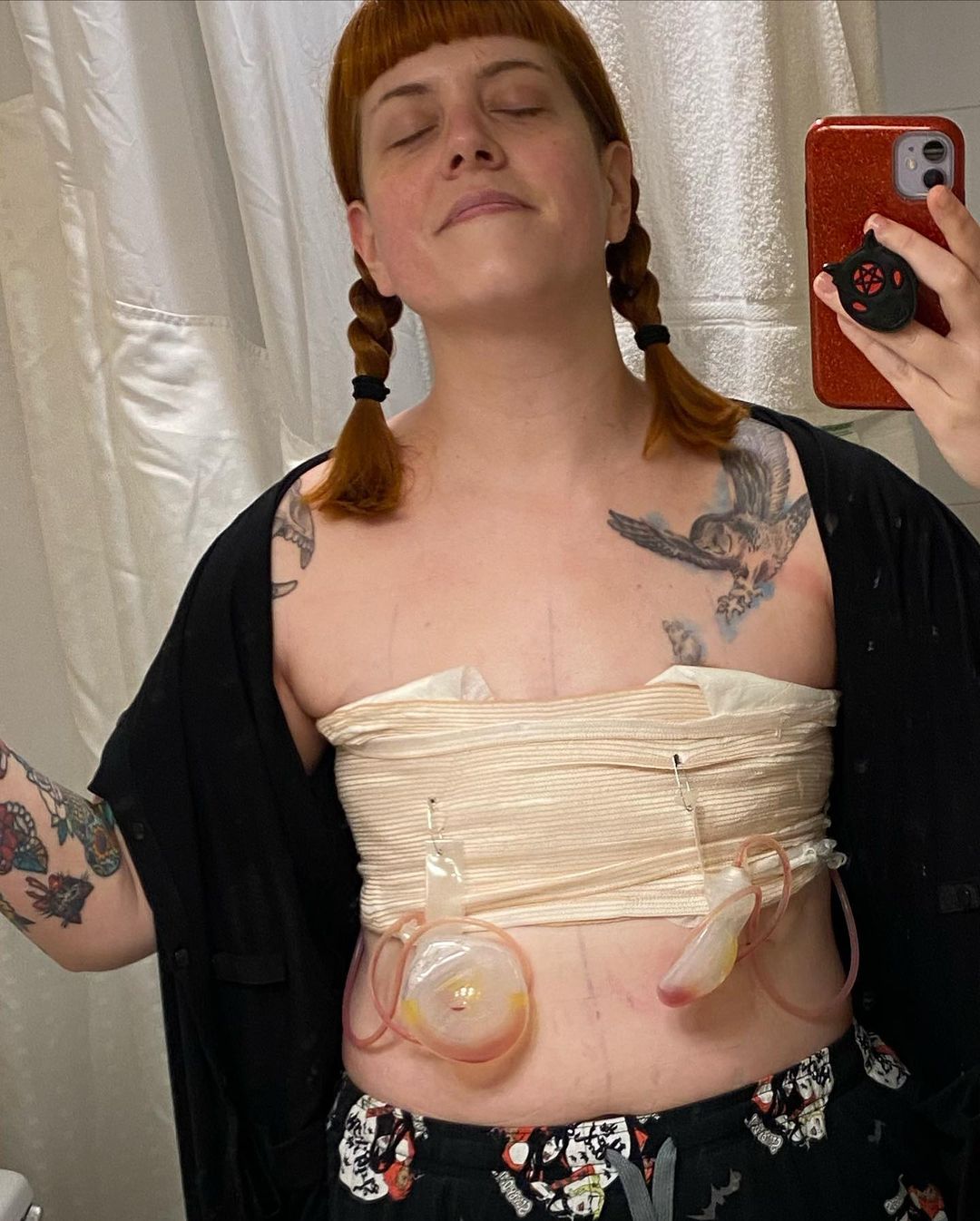 kate-leth-top-surgery-4.jpg