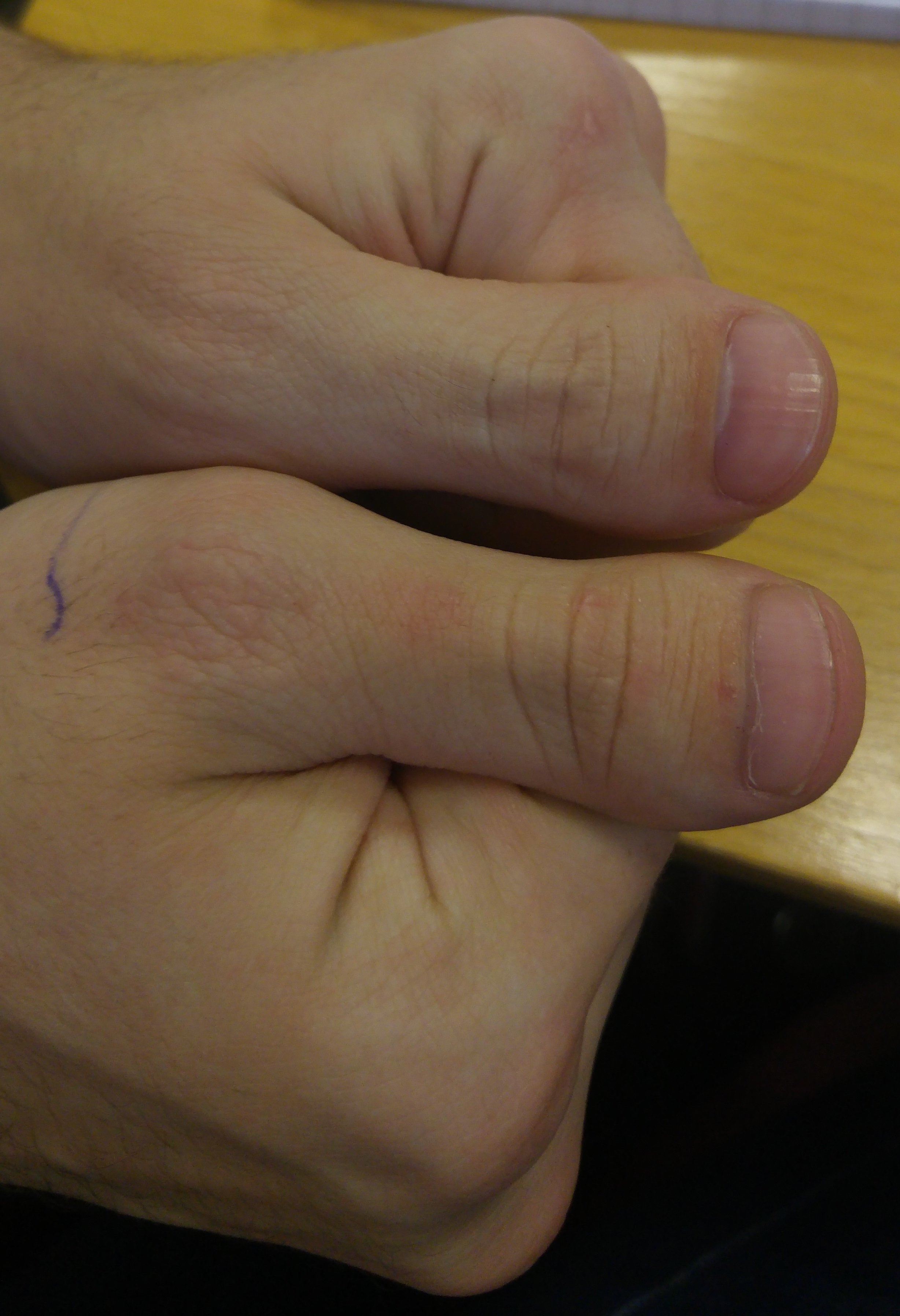 MB-Thumbs.jpg