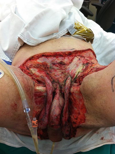necrotic crotch OMGFG.jpg