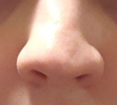 nose.JPG