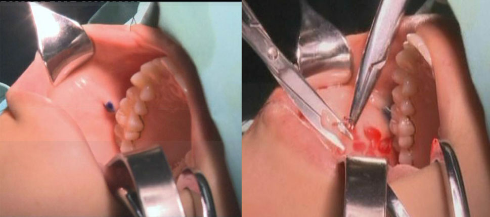 oralteam1.png