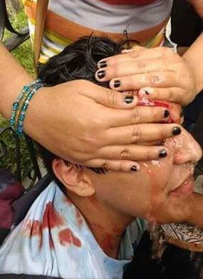 Pelea_campal_entre_Legi%3Fn_Holk_y_SDLG_victima.webp