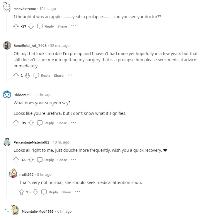 Prolapse_comments.jpg