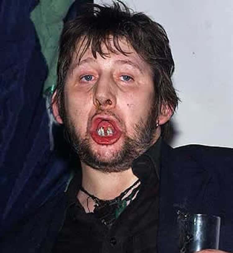shane macgowan.jpg