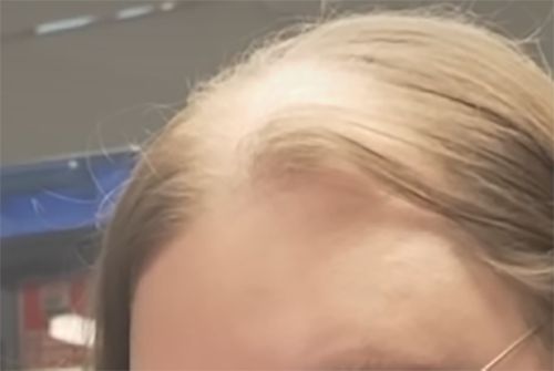 super bald.png