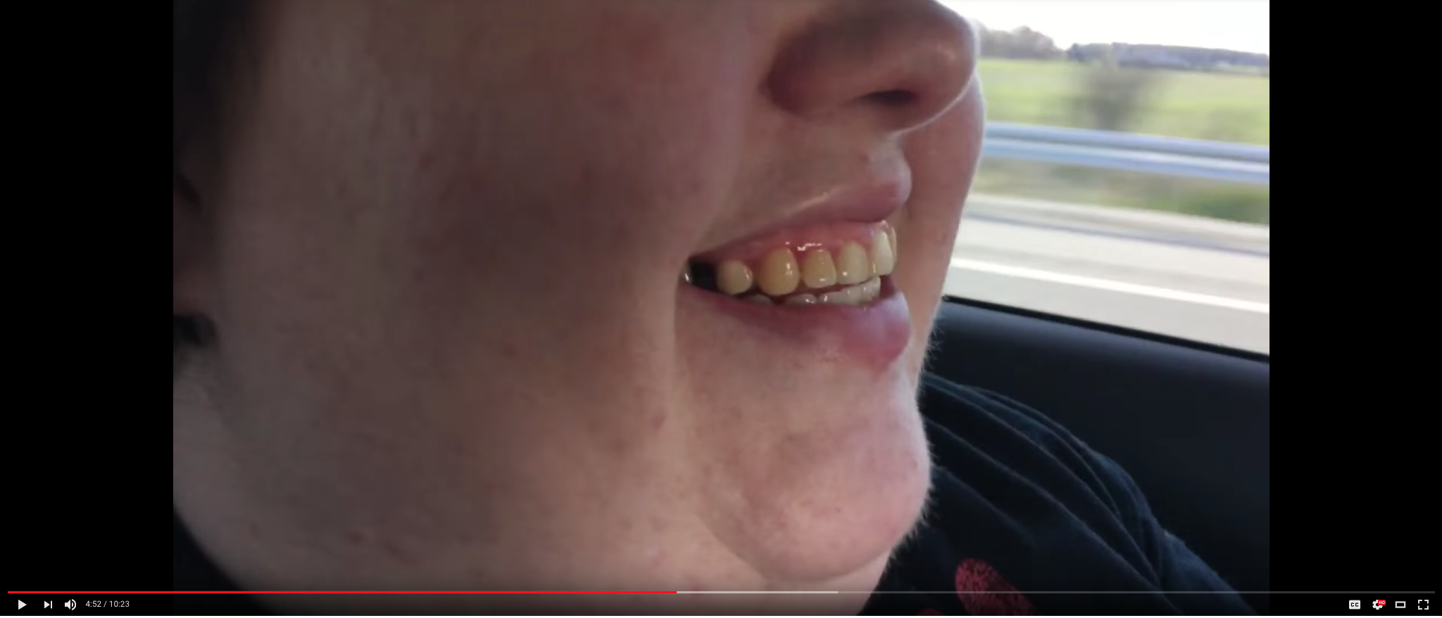 teef2.png