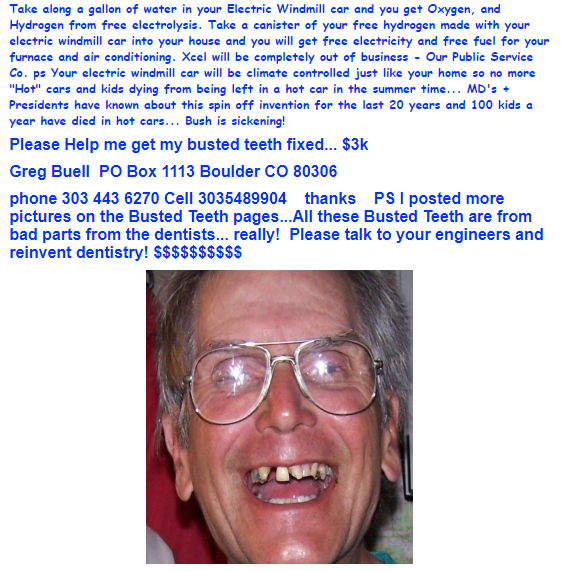 teethhawking.PNG