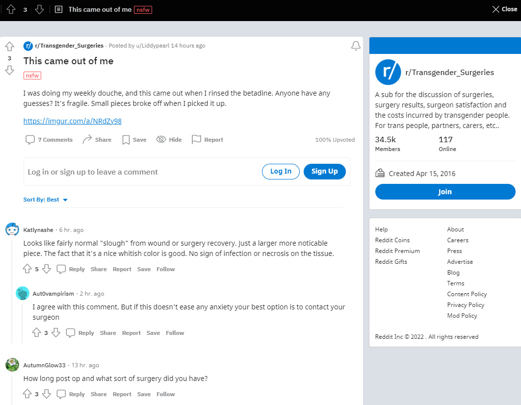 Tonsil_stones_op.jpg