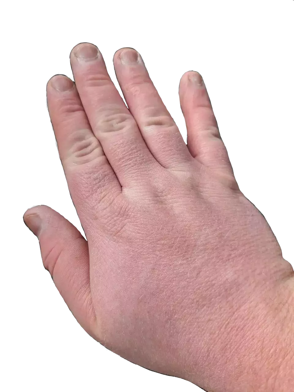 welper hand.webp