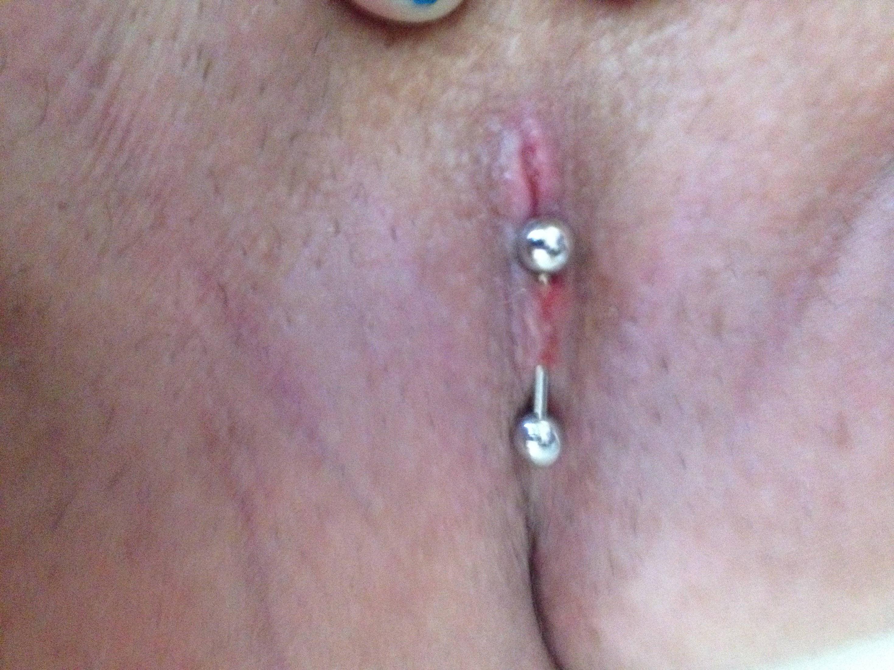 Unclit_%28INFECTED%21%21%21%29.jpg