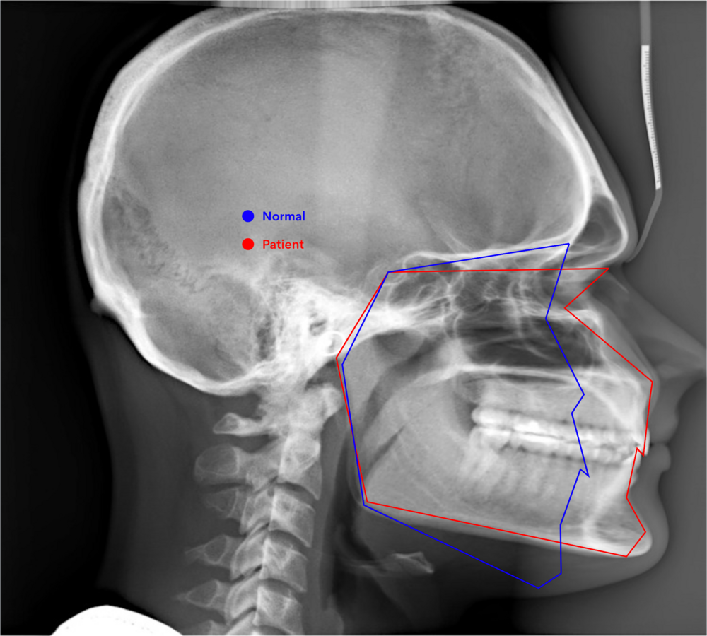 normal-patient-png.1153118
