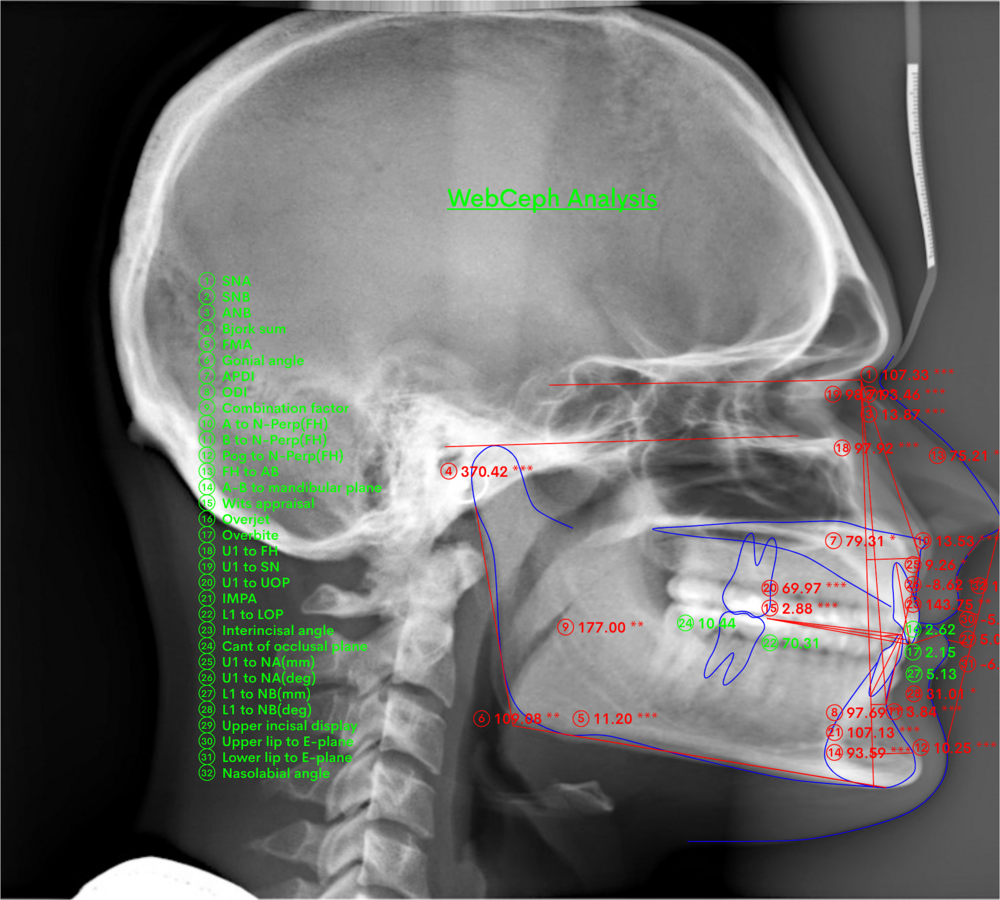 line-analysis-png.1153120