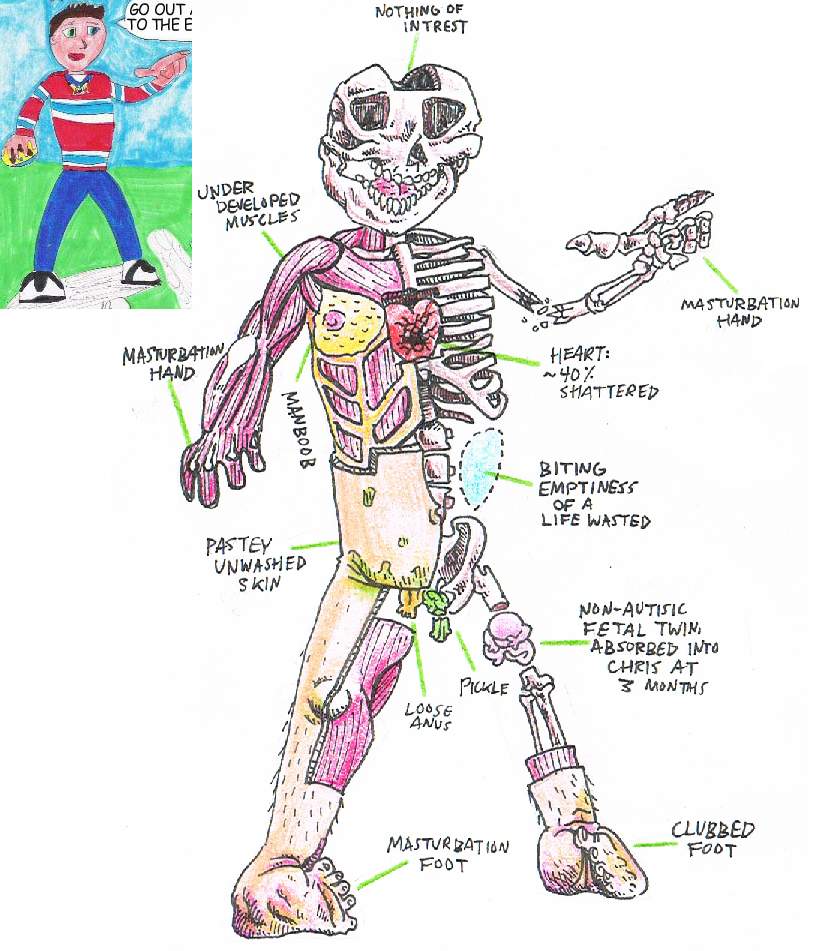 Cwcanatomy.JPG