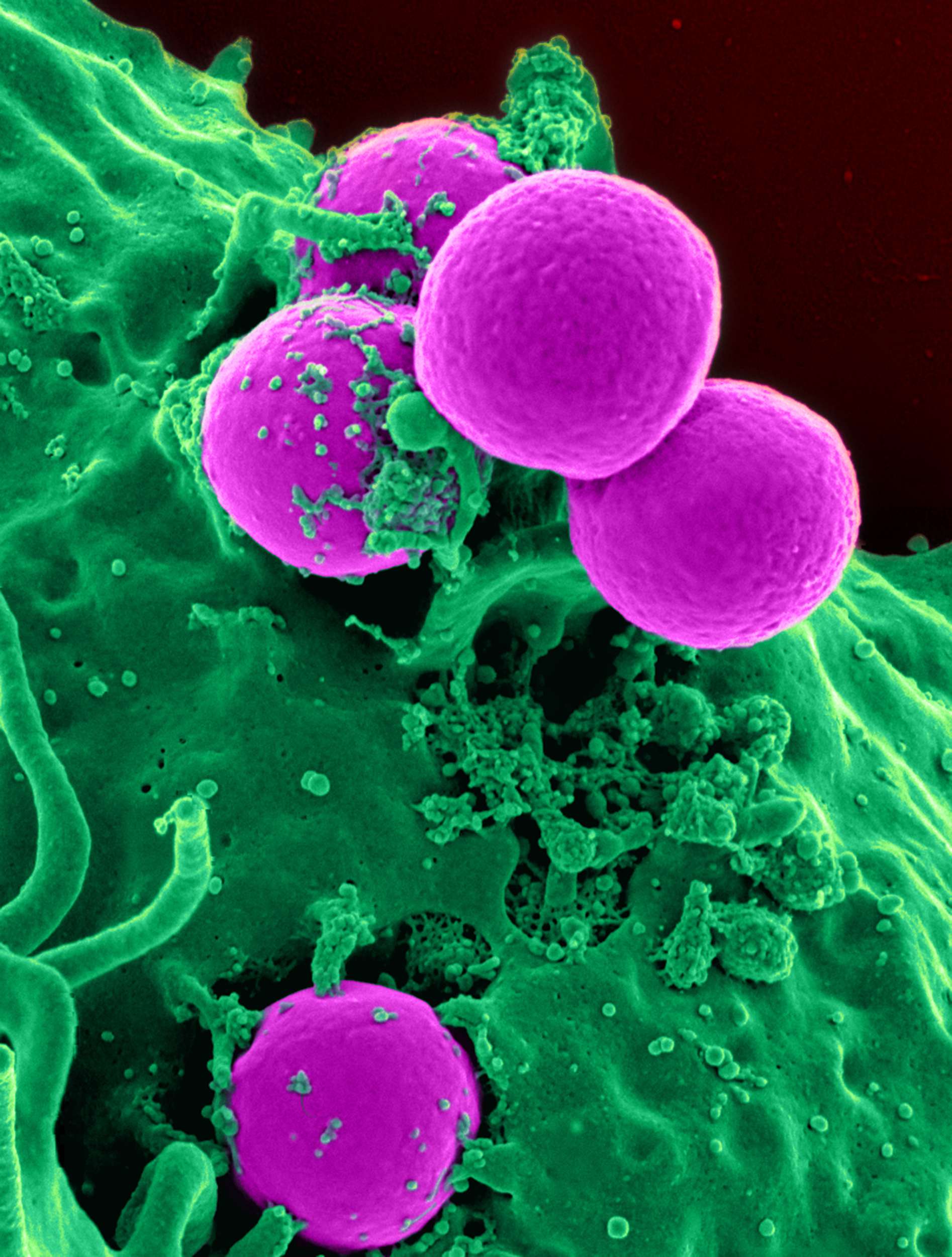 Human_neutrophil_ingesting_MRSA.jpg