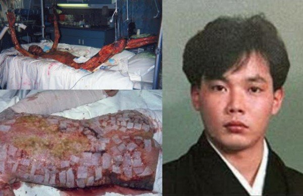 Hisashi-Ouchi.jpg