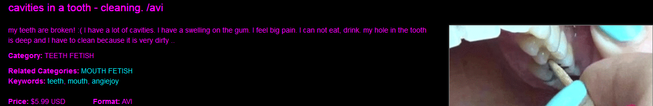 Avmi0ez.png