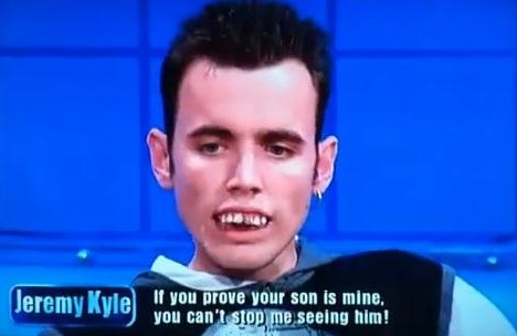 oct-21-jeremy-kyle-teeth.jpg
